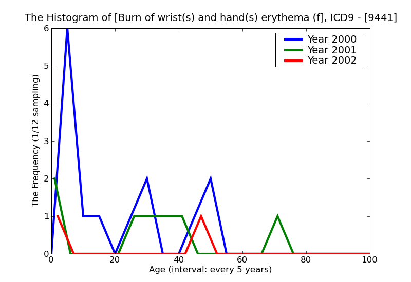 ICD9 Histogram Burn of wrist(s) and hand(s) erythema (first degree)