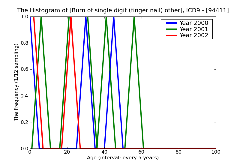 ICD9 Histogram Burn of single digit (finger nail) other than thumb erythema (first degree)