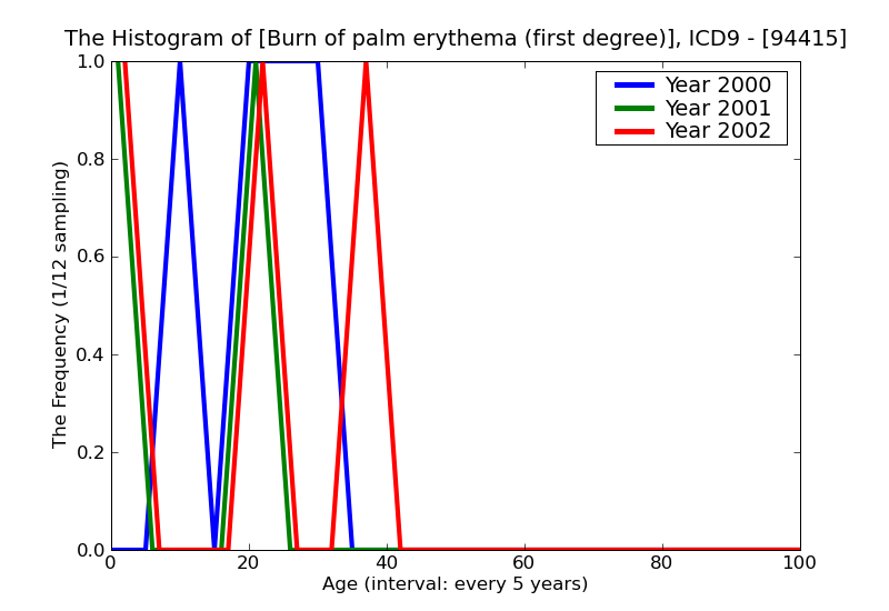 ICD9 Histogram Burn of palm erythema (first degree)