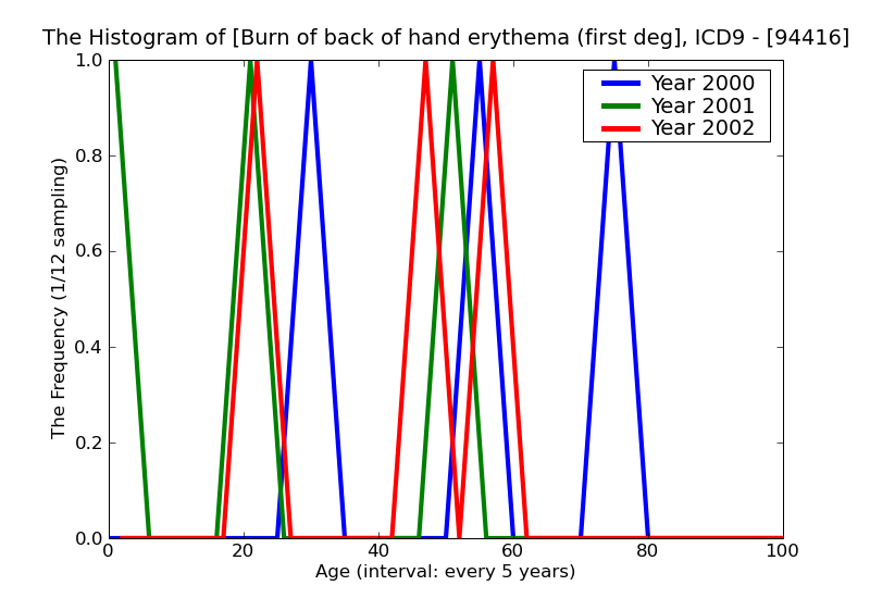 ICD9 Histogram Burn of back of hand erythema (first degree)