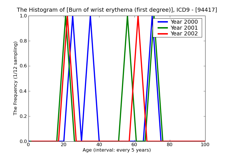 ICD9 Histogram Burn of wrist erythema (first degree)
