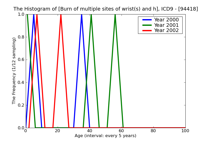 ICD9 Histogram Burn of multiple sites of wrist(s) and hand(s) erythema (first degree)