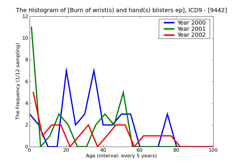 ICD9 Histogram Burn of wrist(s) and hand(s) blisters epidermal loss (second degree)