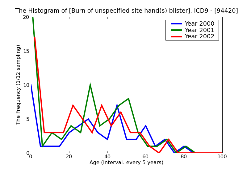 ICD9 Histogram Burn of unspecified site hand(s) blisters epidermal loss (second degree)
