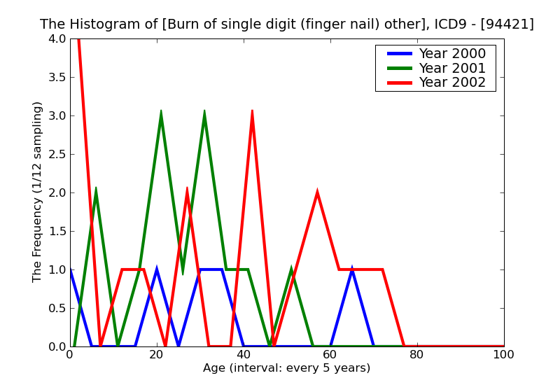 ICD9 Histogram Burn of single digit (finger nail) other than thumb blisters epidermal loss (second degree)