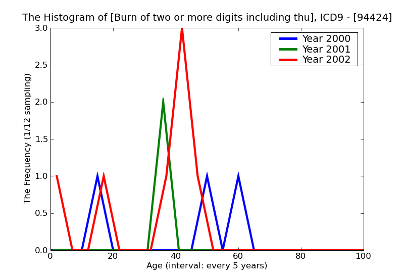 ICD9 Histogram Burn of two or more digits including thumb blisters epidermal loss (second degree)