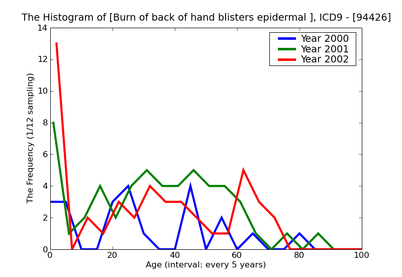 ICD9 Histogram Burn of back of hand blisters epidermal loss (second degree)