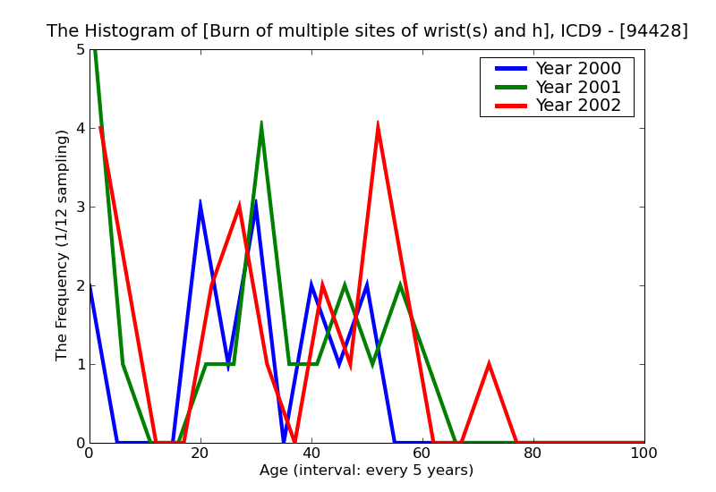 ICD9 Histogram Burn of multiple sites of wrist(s) and hand(s) blisters epidermal loss (second degree)