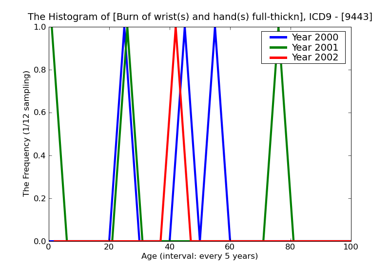 ICD9 Histogram Burn of wrist(s) and hand(s) full-thickness skin loss (third degree NOS)