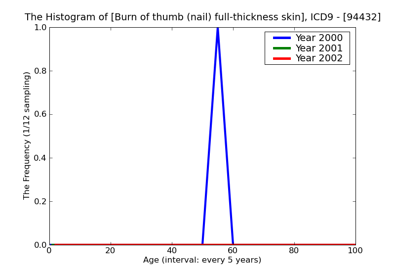 ICD9 Histogram Burn of thumb (nail) full-thickness skin loss (third degree NOS)