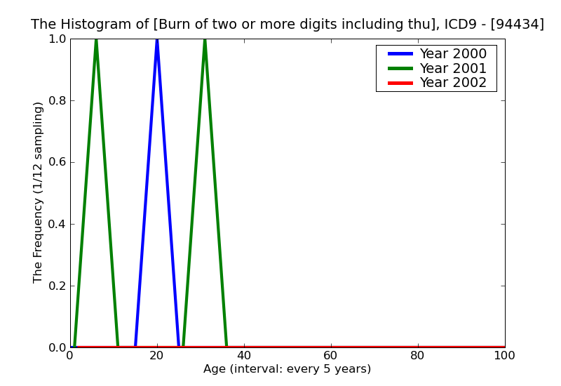 ICD9 Histogram Burn of two or more digits including thumb full-thickness skin loss (third degree NOS)