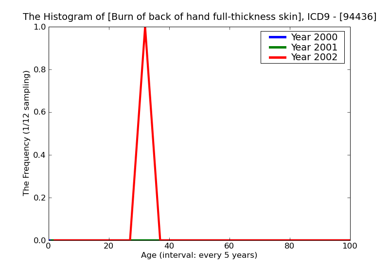 ICD9 Histogram Burn of back of hand full-thickness skin loss (third degree NOS)