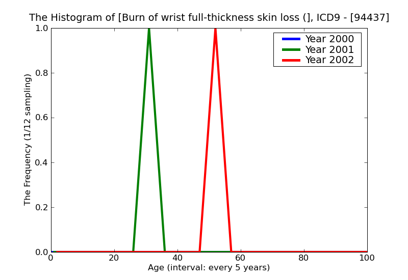 ICD9 Histogram Burn of wrist full-thickness skin loss (third degree NOS)