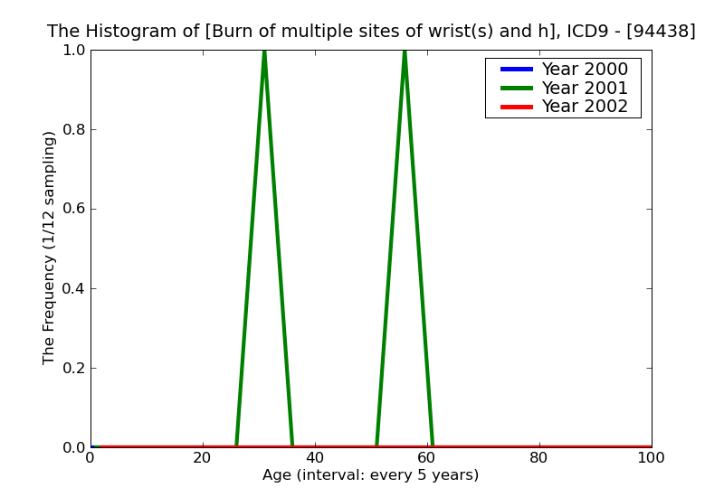 ICD9 Histogram Burn of multiple sites of wrist(s) and hand(s) full-thickness skin loss (third degree NOS)