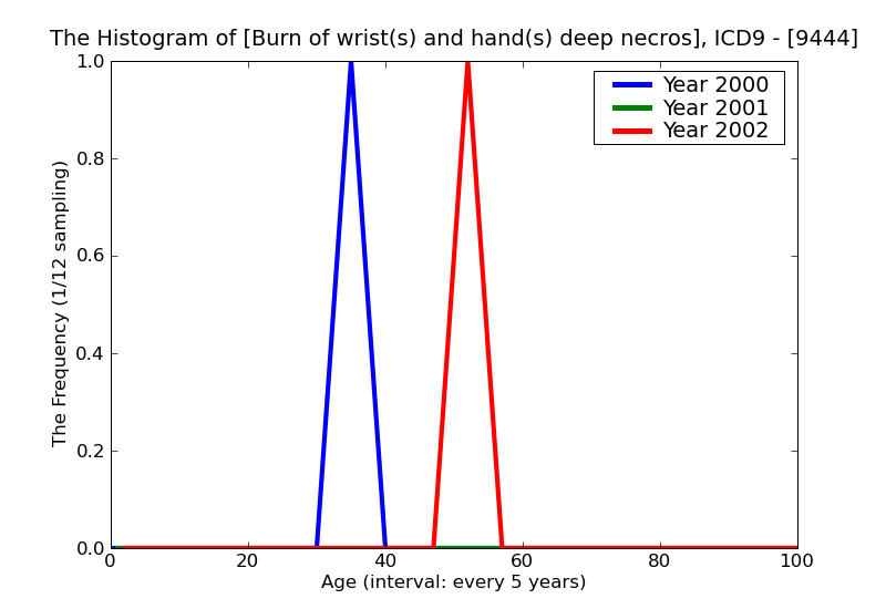 ICD9 Histogram Burn of wrist(s) and hand(s) deep necrosis of underlying tissues (deep third degree) without mention