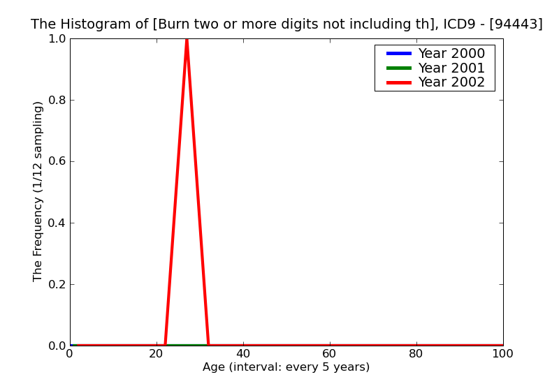 ICD9 Histogram Burn two or more digits not including thumb deep necrosis of underlying tissues (deep third degree)