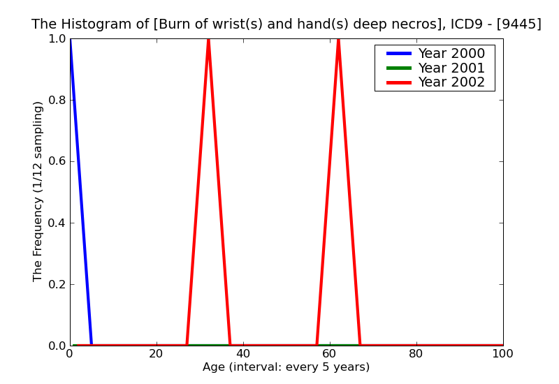 ICD9 Histogram Burn of wrist(s) and hand(s) deep necrosis of underlying tissues (deep third degree) with mention of