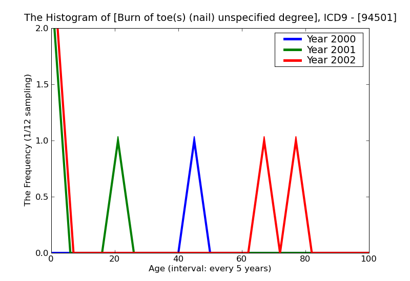 ICD9 Histogram Burn of toe(s) (nail) unspecified degree