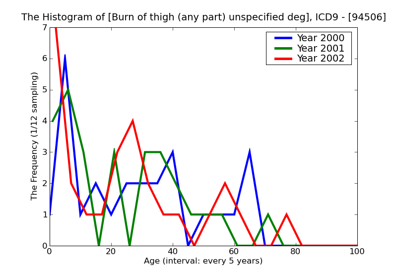 ICD9 Histogram Burn of thigh (any part) unspecified degree