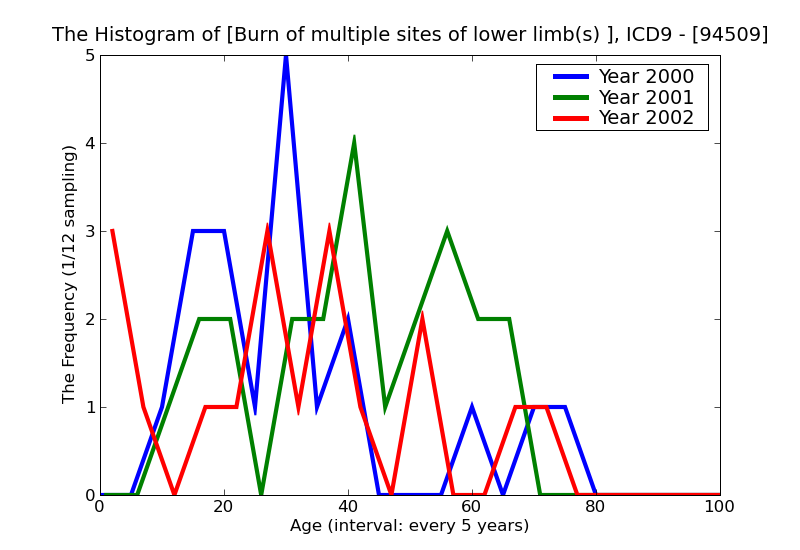 ICD9 Histogram Burn of multiple sites of lower limb(s) unspecified degree