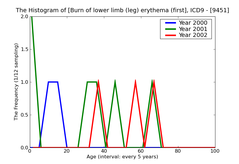 ICD9 Histogram Burn of lower limb (leg) erythema (first degree)