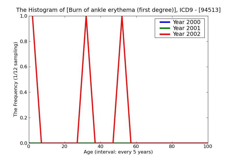ICD9 Histogram Burn of ankle erythema (first degree)