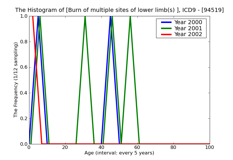 ICD9 Histogram Burn of multiple sites of lower limb(s) erythema (first degree)