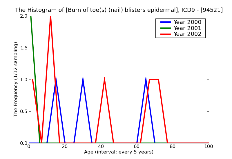 ICD9 Histogram Burn of toe(s) (nail) blisters epidermal loss (second degree)