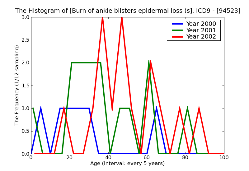 ICD9 Histogram Burn of ankle blisters epidermal loss (second degree)