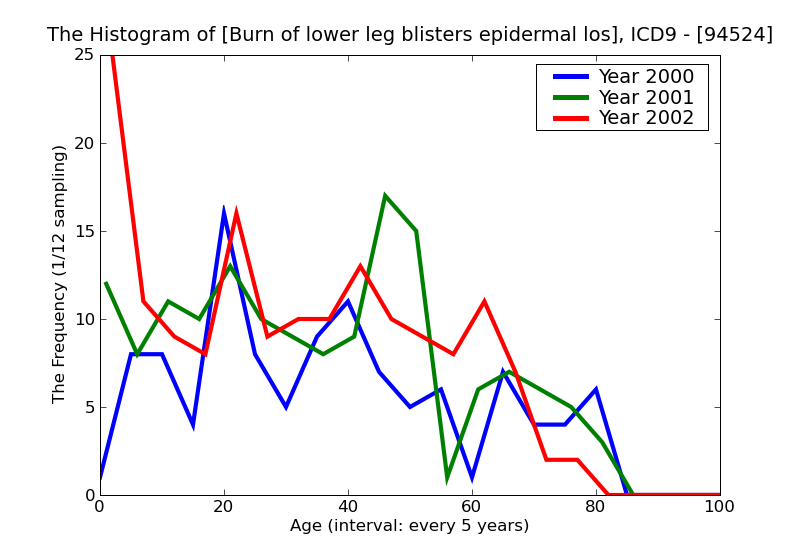 ICD9 Histogram Burn of lower leg blisters epidermal loss (second degree)