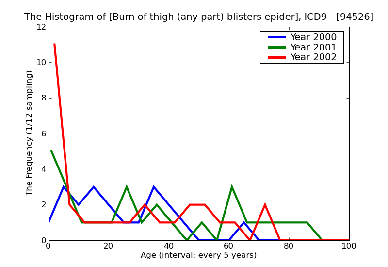 ICD9 Histogram Burn of thigh (any part) blisters epidermal loss (second degree)