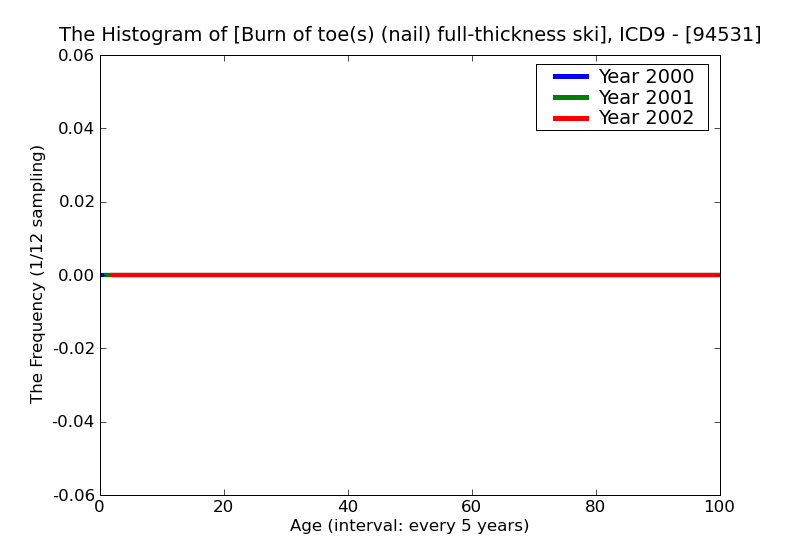 ICD9 Histogram Burn of toe(s) (nail) full-thickness skin loss (third degree NOS)