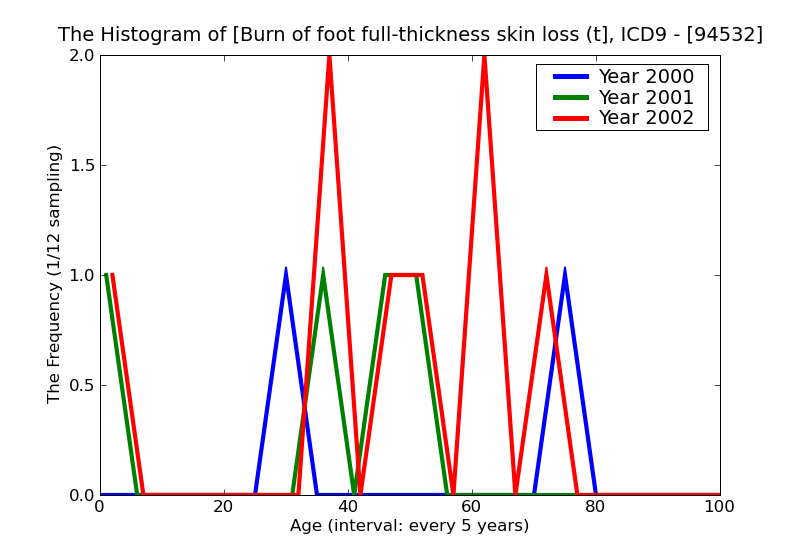 ICD9 Histogram Burn of foot full-thickness skin loss (third degree NOS)