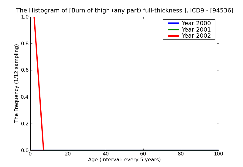 ICD9 Histogram Burn of thigh (any part) full-thickness skin loss (third degree NOS)