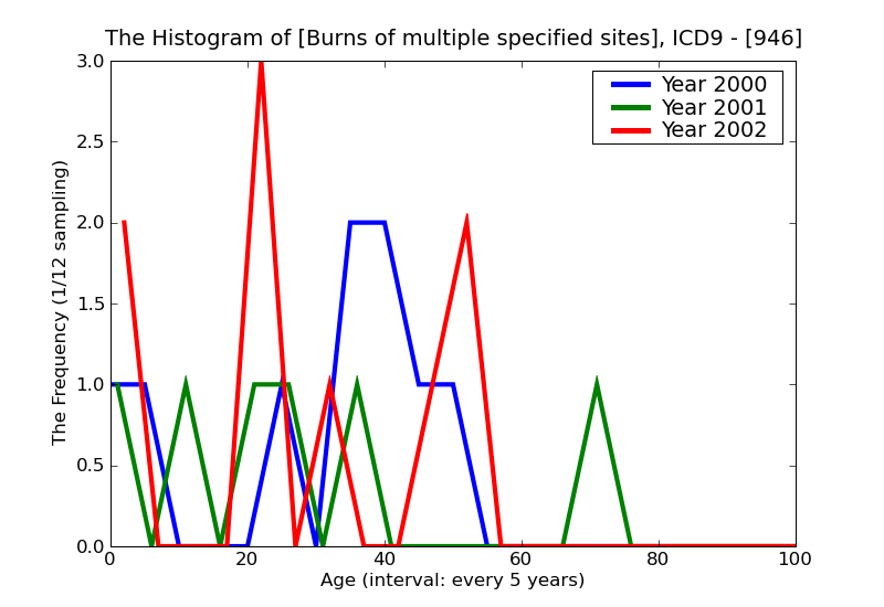 ICD9 Histogram Burns of multiple specified sites