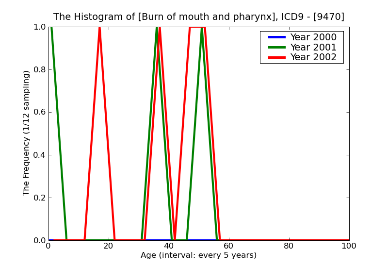 ICD9 Histogram Burn of mouth and pharynx