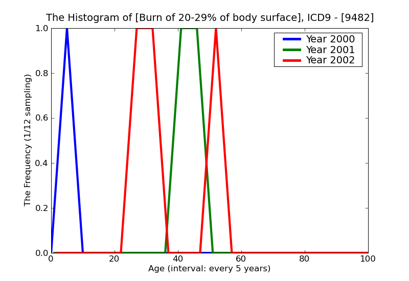 ICD9 Histogram Burn of 20-29% of body surface