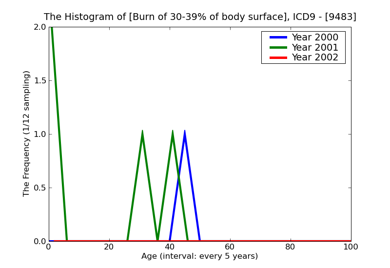 ICD9 Histogram Burn of 30-39% of body surface