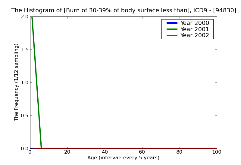 ICD9 Histogram Burn of 30-39% of body surface less than 10% or unspecified third degree
