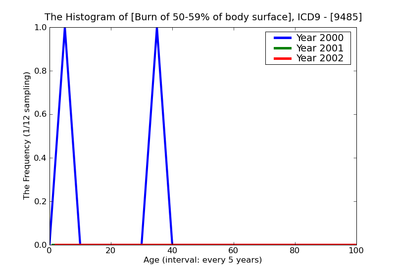 ICD9 Histogram Burn of 50-59% of body surface