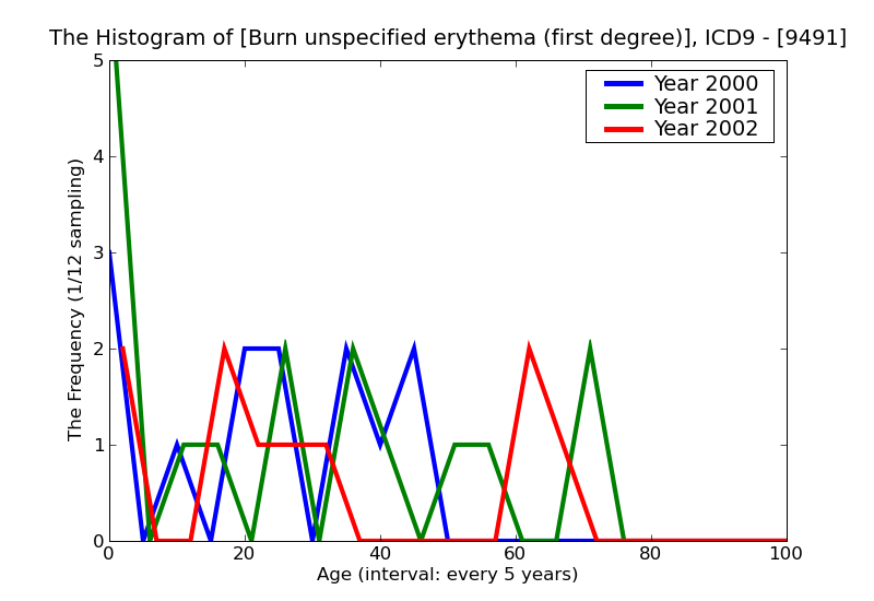 ICD9 Histogram Burn unspecified erythema (first degree)