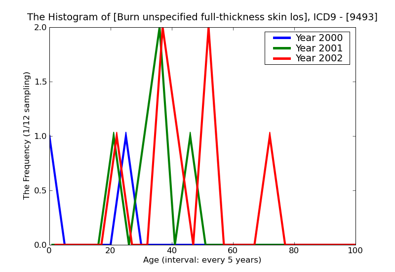 ICD9 Histogram Burn unspecified full-thickness skin loss (third degree NOS)