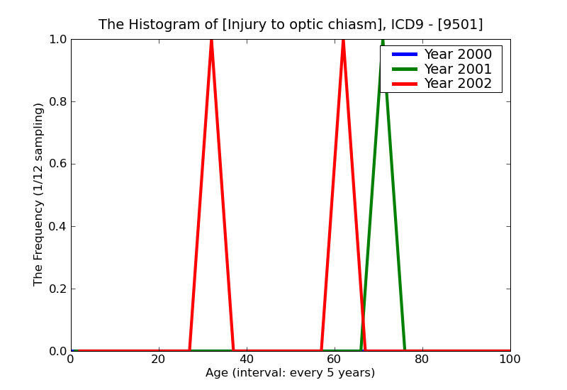 ICD9 Histogram Injury to optic chiasm