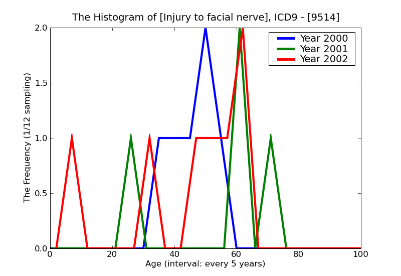 ICD9 Histogram Injury to facial nerve
