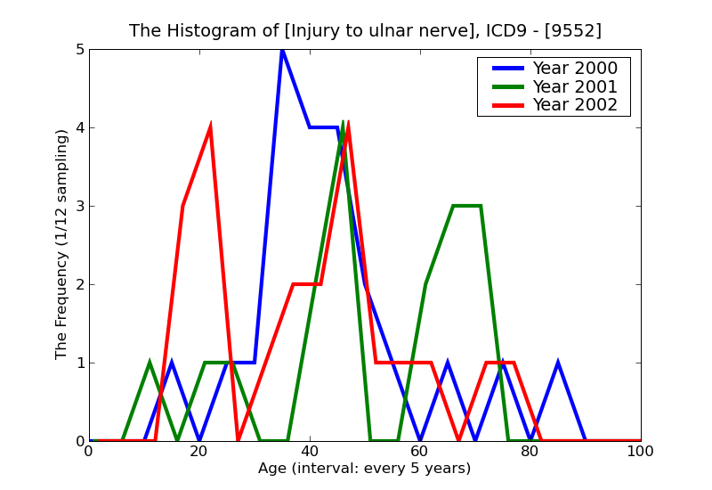 ICD9 Histogram Injury to ulnar nerve