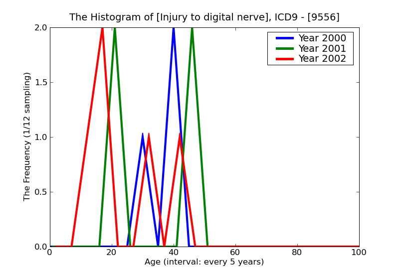 ICD9 Histogram Injury to digital nerve