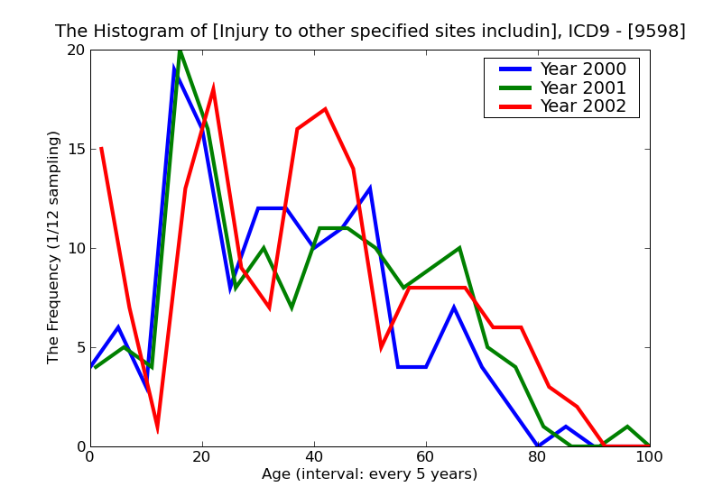 ICD9 Histogram Injury to other specified sites including multiple
