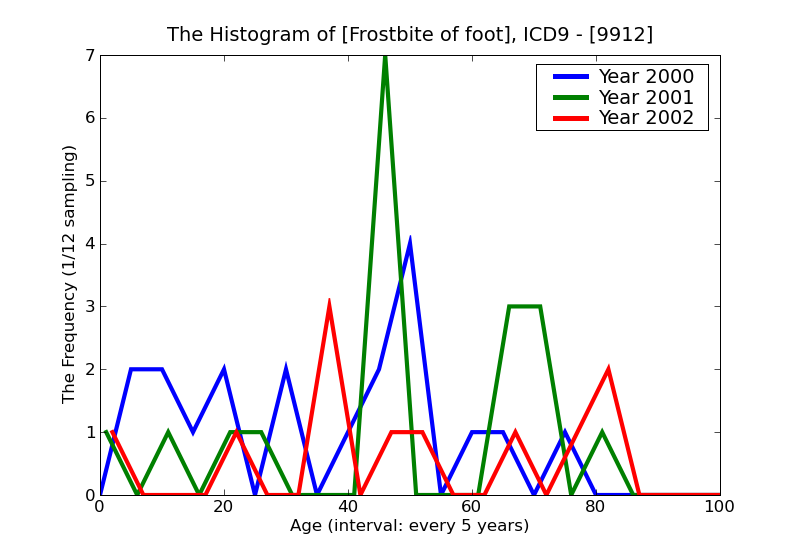 ICD9 Histogram Frostbite of foot