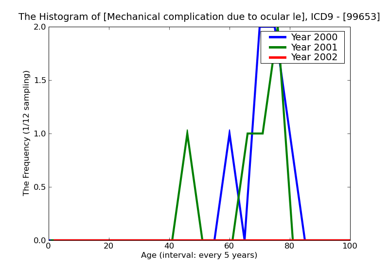 ICD9 Histogram Mechanical complication due to ocular lens prosthesis
