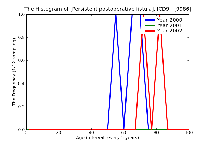 ICD9 Histogram Persistent postoperative fistula